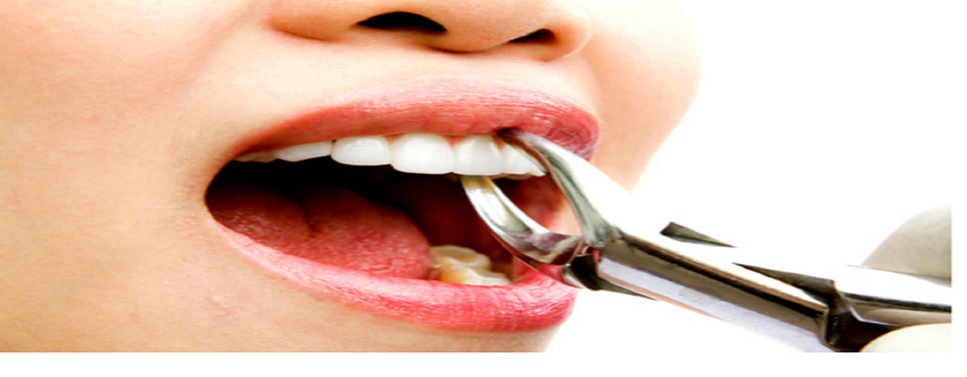 Best Dental clinic in gomti nagar extension
