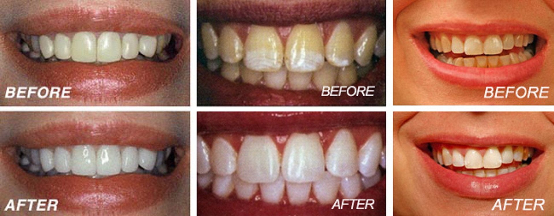 Best Dental clinic in gomti nagar extension