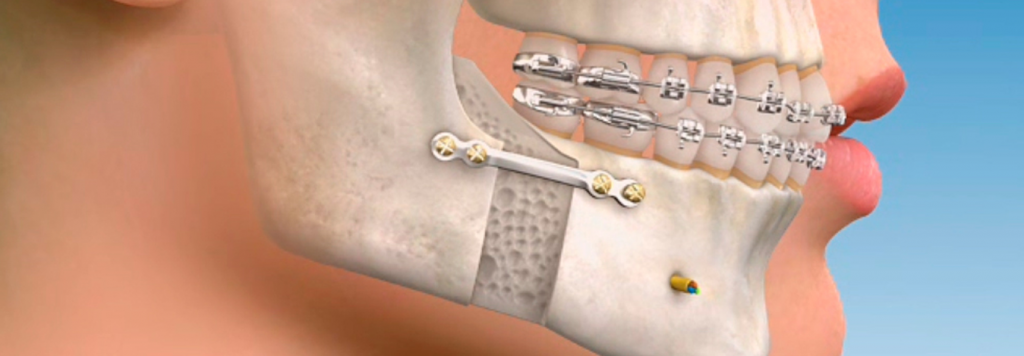 Smile Hub Superspeciality Dental & Maxillofacial Clinic