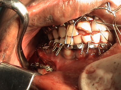 Smile Hub Superspeciality Dental & Maxillofacial Clinic