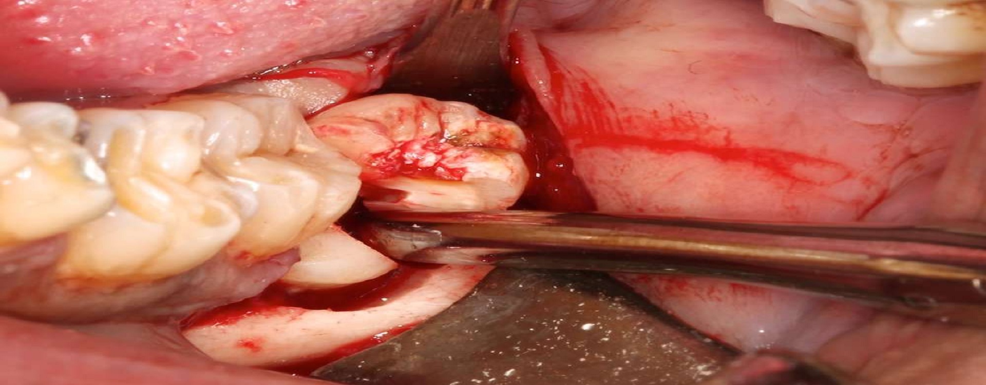 Best dental treatment in vibhuti khand lko