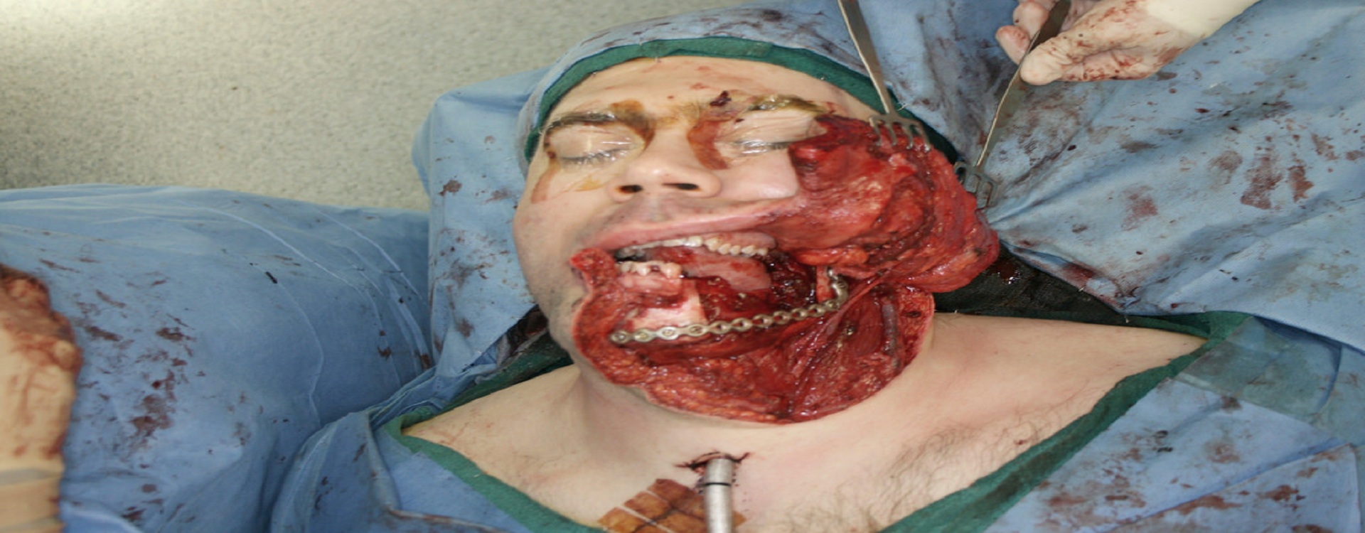 Best dental treatment in vibhuti khand lko