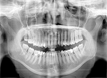 Dental Clinic in Gomti Nagar,Dental Clinic in vibhuti khand,Dental clinic in vishesh khand,dental clinic near shaheed path,Dentist in Gomti Nagar,Dentist in vibhuti khand,Dentist in vishesh khand,Dentist near shaheed path,Dental clinic in lucknow,dentist in lucknow,top dental clinic in gomti nagar,top dental clinic in vibhuti khand,top dental clinic in vishesh khand,top dental clinic  near shaheed path,top dentist in gomti nagar,top dentist in vibhuti khand,top dentist in vishesh khand