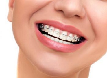 Dental Clinic in Gomti Nagar,Dental Clinic in vibhuti khand,Dental clinic in vishesh khand,dental clinic near shaheed path,Dentist in Gomti Nagar,Dentist in vibhuti khand,Dentist in vishesh khand,Dentist near shaheed path,Dental clinic in lucknow,dentist in lucknow,top dental clinic in gomti nagar,top dental clinic in vibhuti khand,top dental clinic in vishesh khand,top dental clinic  near shaheed path,top dentist in gomti nagar,top dentist in vibhuti khand,top dentist in vishesh khand